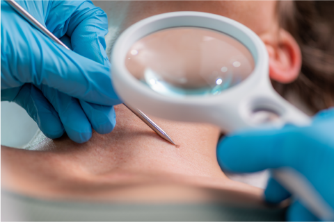 dermatology